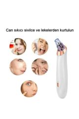 Yüz Temizleme Cihazı Siyah Nokta Vakumlu